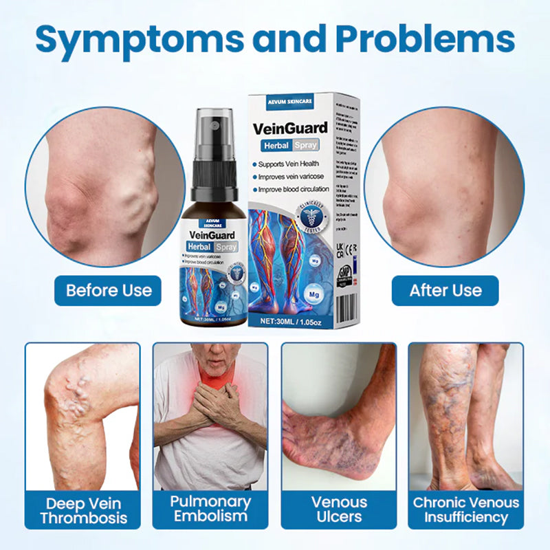🔥 Up to 80% OFF! 🔥 VeinGuard Herbal Spray - 94% of users see visible results within 1 to 2 weeks!