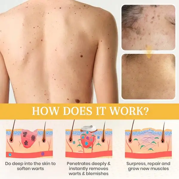 NatureStore Instant Mole & Spot Cream