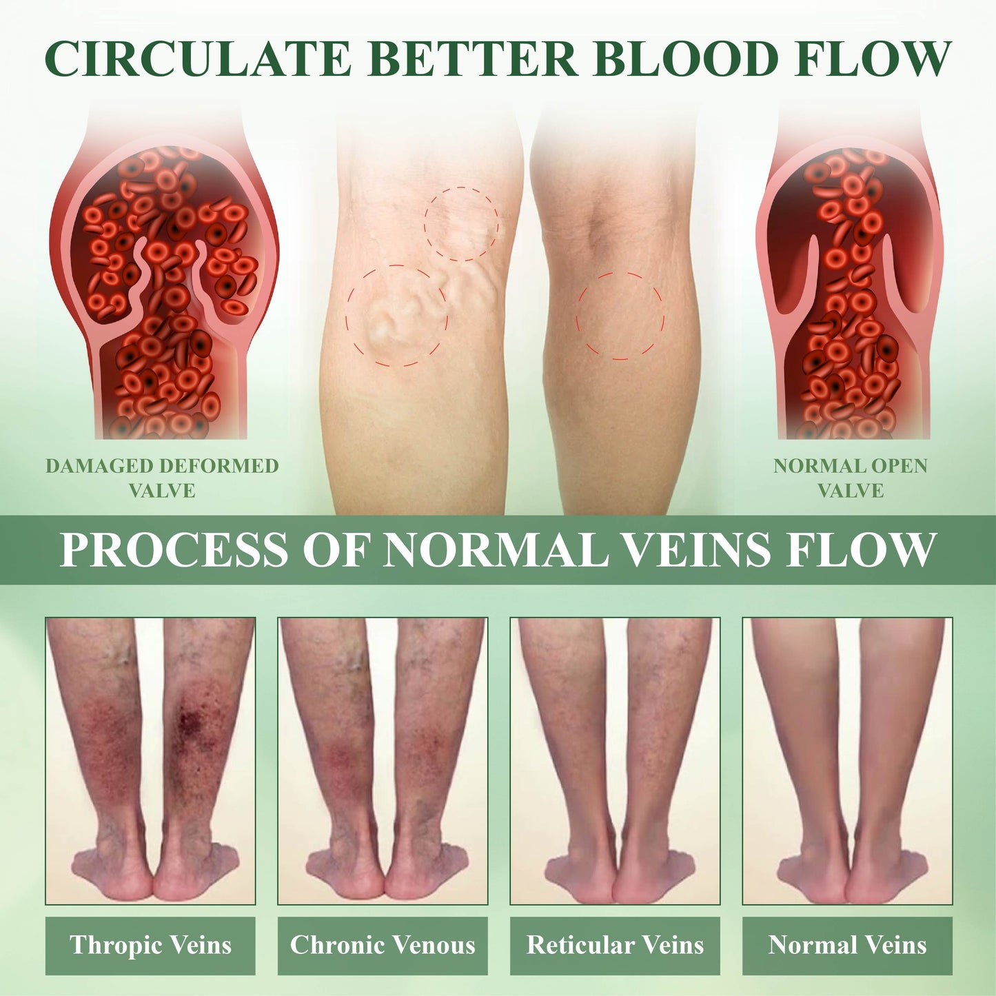 FluidEase Leg Therapy Edema Cream – See results within just one week!