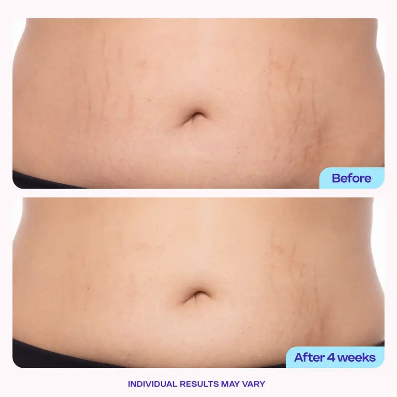 New! Tighten & Smooth Belly Firming Cream – See Results Fast in 7 Days ⏱️