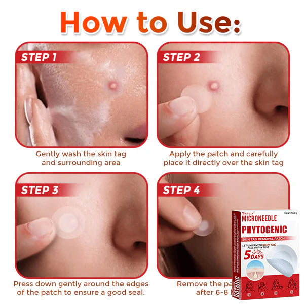 Skavix® MicroNeedle Botanic Skin Tag Removal Patch ✅Australian Made