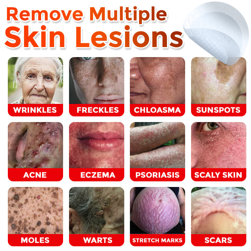 Skavix® MicroNeedle Botanic Skin Tag Removal Patch ✅Australian Made