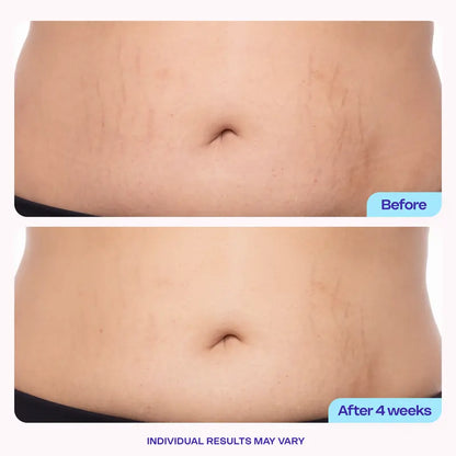 New! Tighten & Smooth Belly Firming Cream – See Results Fast in 7 Days ⏱️
